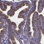 Anti-RERG Antibody