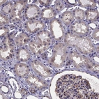Immunohistochemical staining of human kidney shows moderate cytoplasmic positivity in cells in tubules and glomeruli