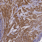 Immunohistochemical staining of human prostate shows strong cytoplasmic positivity in smooth muscle cells.