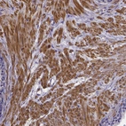 Immunohistochemical staining of human prostate shows strong cytoplasmic positivity in smooth muscle cells.