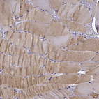 Immunohistochemical staining of human skeletal muscle shows moderate cytoplasmic positivity in myocytes.