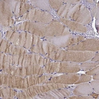Immunohistochemical staining of human skeletal muscle shows moderate cytoplasmic positivity in myocytes.