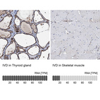 Anti-IVD Antibody