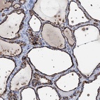 Anti-IVD Antibody