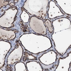 Immunohistochemical staining of human thyroid gland shows high expression.