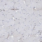 Immunohistochemical staining of human skeletal muscle shows low expression as expected.
