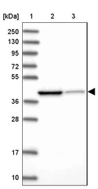 Lane 1: Marker [kDa] 250, 130, 95, 72, 55, 36, 28, 17, 10_br/_Lane 2: Human cell line RT-4_br/_Lane 3: Human cell line U-251MG sp