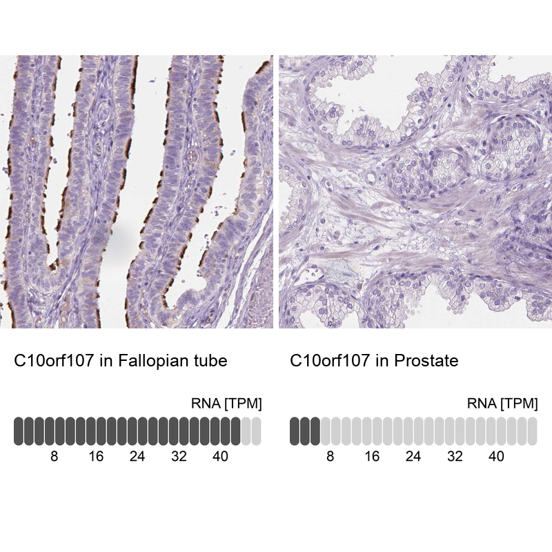 Anti-C10orf107 Antibody