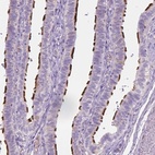 Immunohistochemical staining of human fallopian tube shows high expression.