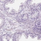 Immunohistochemical staining of human prostate shows low expression as expected.