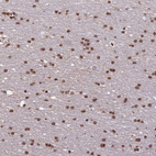 Immunohistochemical staining of human cerebral cortex shows moderate nuclear positivity in glial cells.