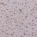 Immunohistochemical staining of human cerebral cortex shows moderate nuclear positivity in glial cells.
