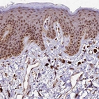 Immunohistochemical staining of human skin shows moderate nuclear positivity in squamous epithelial cells.
