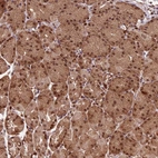 Immunohistochemical staining of human stomach shows moderate nuclear positivity in glandular cells.