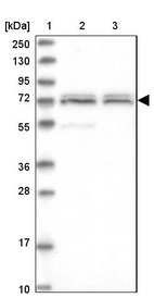 Lane 1: Marker [kDa] 250, 130, 95, 72, 55, 36, 28, 17, 10_br/_Lane 2: Human cell line RT-4_br/_Lane 3: Human cell line U-251MG sp