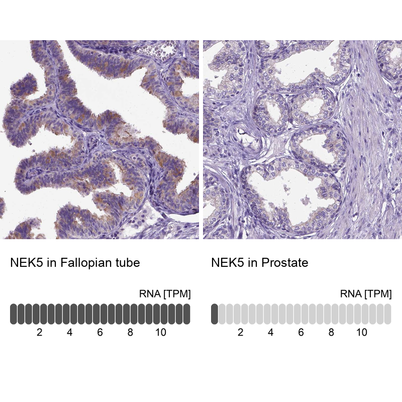 Anti-NEK5 Antibody