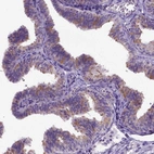 Immunohistochemical staining of human fallopian tube shows high expression.