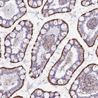 Anti-CHMP4B Antibody