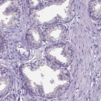 Immunohistochemical staining of human prostate shows low expression as expected.
