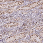 Immunohistochemical staining of human kidney shows moderate to strong granular cytoplasmic positivity in cells in tubules.