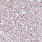 Immunohistochemical staining of human liver shows weak granular cytoplasmic positivity in hepatocytes as expected.