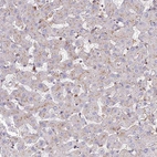 Immunohistochemical staining of human liver shows weak granular cytoplasmic positivity in hepatocytes as expected.