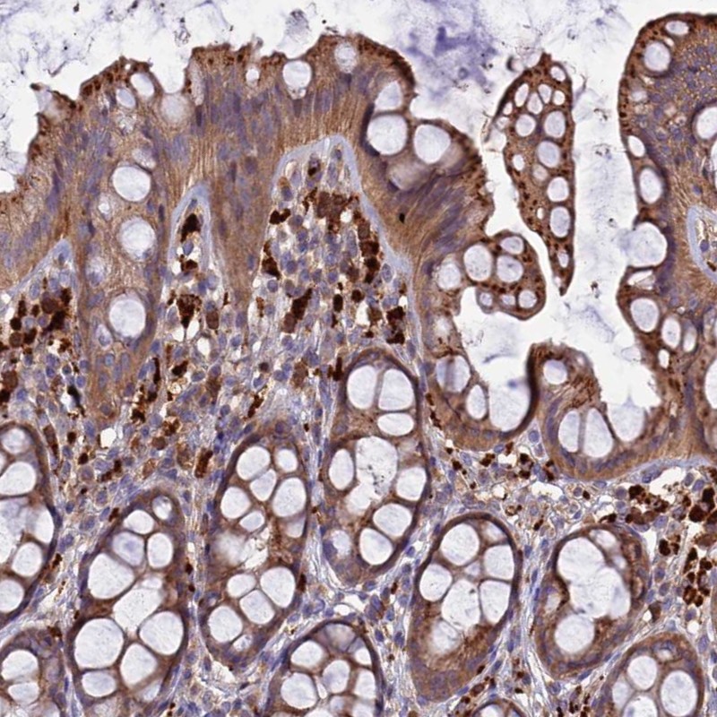 Anti-CARMIL2 Antibody