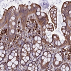 Anti-CARMIL2 Antibody