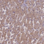 Anti-PZP Antibody