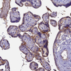 Immunohistochemical staining of human placenta shows moderate positivity in trophoblastic cells and plasma.