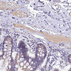 Immunohistochemical staining of human small intestine shows moderate positivity in glandular cells and in plasma.