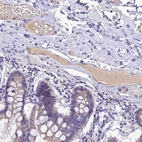 Immunohistochemical staining of human small intestine shows moderate positivity in glandular cells and in plasma.