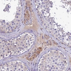Immunohistochemical staining of human testis shows moderate cytoplasmic positivity in Leydig cells and in plasma.