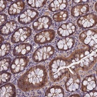 Anti-MVD Antibody