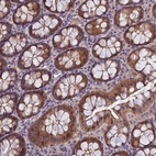 Anti-MVD Antibody