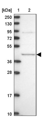 Lane 1: Marker [kDa] 250, 130, 95, 72, 55, 36, 28, 17, 10_br/_Lane 2: Human cell line RT-4