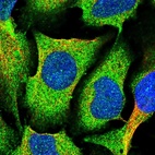 Immunofluorescent staining of human cell line U-2 OS shows positivity in cytoplasm.