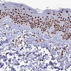 Immunohistochemical staining of human skin shows strong nuclear positivity in squamous epithelial cells.