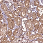 Anti-ANKS3 Antibody