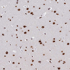 Immunohistochemical staining of human cerebral cortex shows strong nuclear positivity in neuronal cells.
