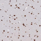 Immunohistochemical staining of human cerebral cortex shows strong nuclear positivity in neuronal cells.