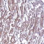 Immunohistochemical staining of human Heart muscle shows moderate cytoplasmic positivity in cardiomyocytes.