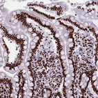 Immunohistochemical staining of human small intestine shows moderate to strong nuclear positivity in glandular cells.