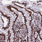 Anti-SRRM2 Antibody