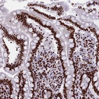 Immunohistochemical staining of human small intestine shows moderate to strong nuclear positivity in glandular cells.
