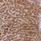 Immunohistochemical staining of human Liver shows strong cytoplasmic positivity in hepatocytes.
