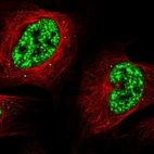 Immunofluorescent staining of human cell line U-2 OS shows localization to nuclear speckles.