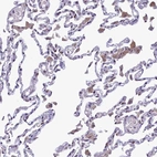 Immunohistochemical staining of human Lung shows moderate cytoplasmic positivity in pneumocytes.