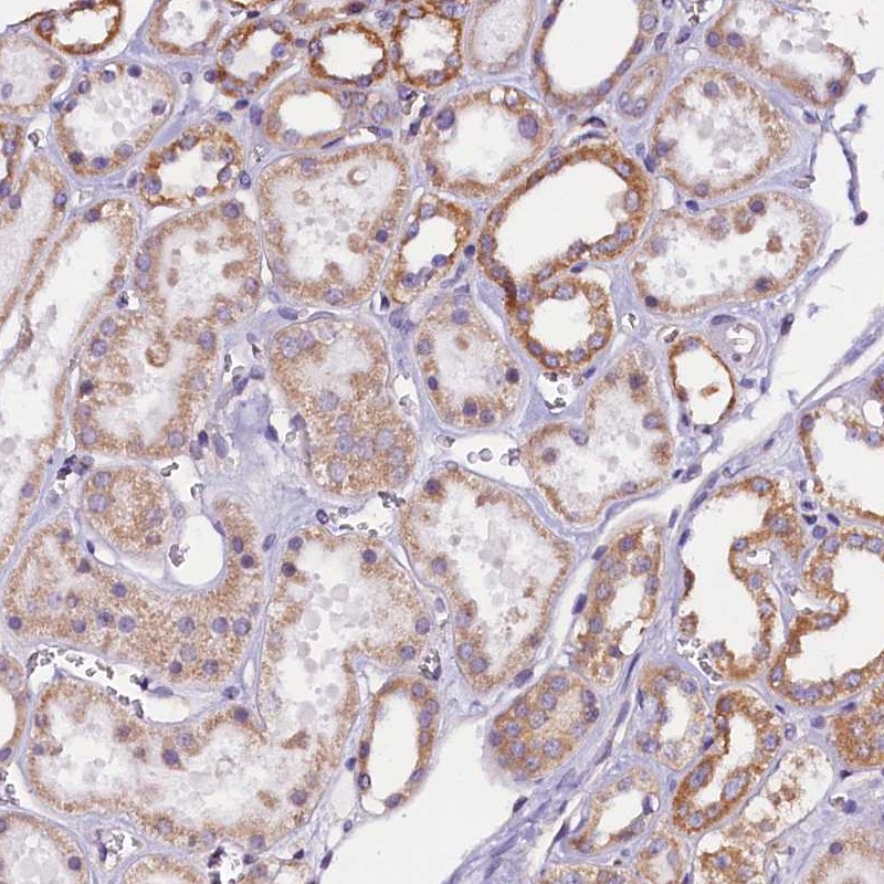 Anti-UACA Antibody