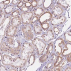 Anti-UACA Antibody
